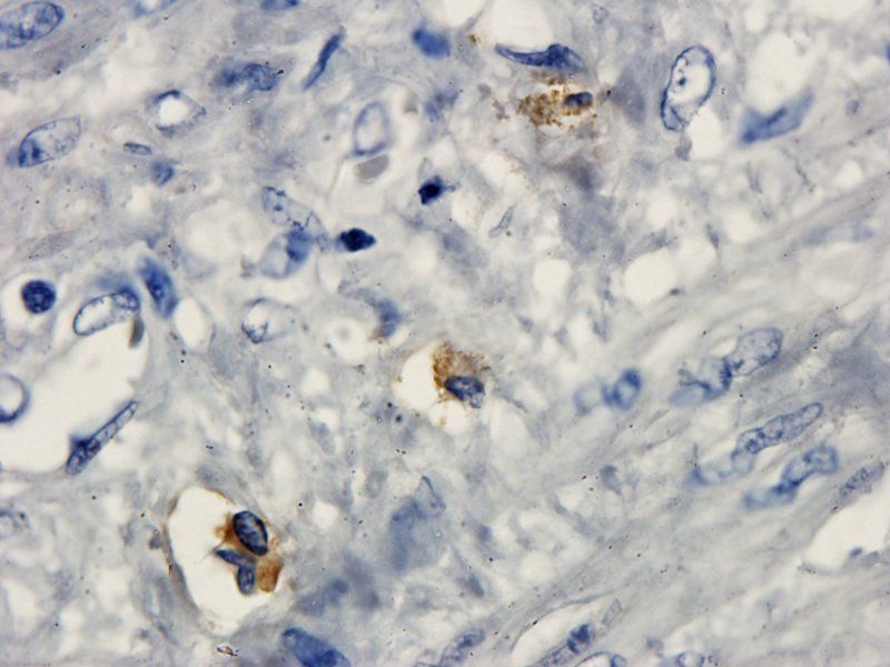 HE4 antibody抗体，orb101171，biorb