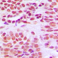 Histone Deacetylase 1 Antibody