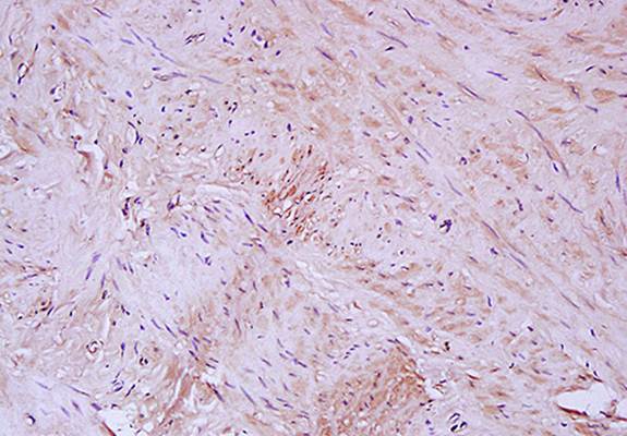 Elastin antibody抗体，orb13391，bi