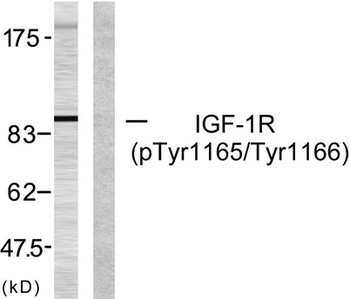 IGF-IR (phospho Tyr1165/Y1166)