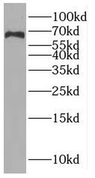 RUNDC3A Antibody抗体，orb630898，b