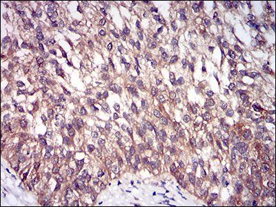 DIS3L2 Antibody抗体,orb153515,bi