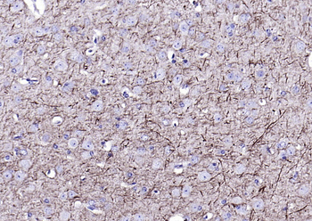 NF-L Mouse Monoclonal Antibody