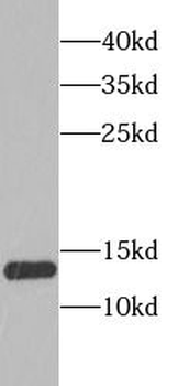 SSBP1 Antibody抗体，orb631521，bio