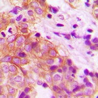 MARK2 Antibody抗体，orb256676，bio