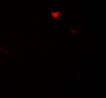 PPM1D Antibody抗体，orb1239193，bi