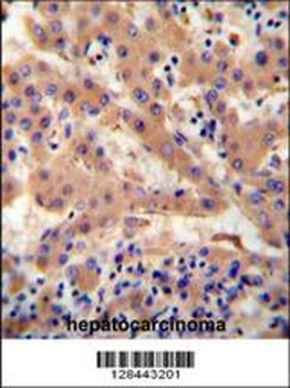 HP Antibody抗体，orb1270670，biorb