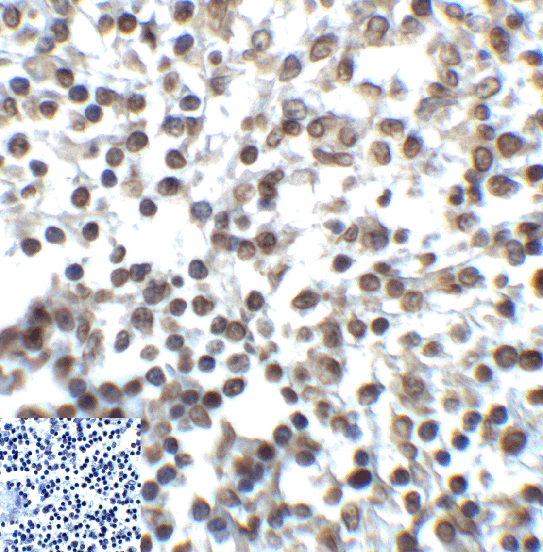 TIGIT Antibody [4A11]抗体，orb124