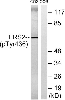 FRS2 (phospho Tyr436) rabbit p