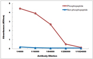 GSK3 beta (Phospho-S9) Antibod