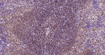 Bcl-2 Recombinant Rabbit Monoc