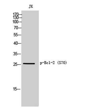 Bcl-2 (phospho Ser70) rabbit p