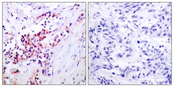 NFκB-p65 (phospho Ser468) rabb