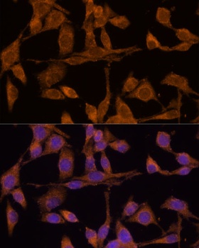 USP15 Antibody抗体,orb1256774,bi