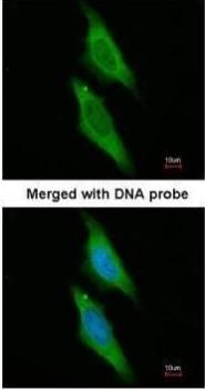 ARA9 antibody [N1C3]抗体，orb5567
