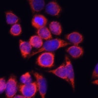 CD282 Antibody抗体，orb411837，bio