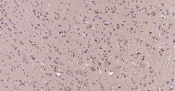 STMN1 Mouse Monoclonal Antibod