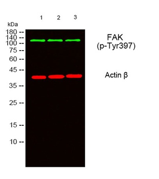 FAK (phospho Tyr397) rabbit pA
