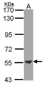 ENTPD3 antibody [N3C3]抗体，orb556163，biorbyt价格_品牌:biorbyt-丁香通