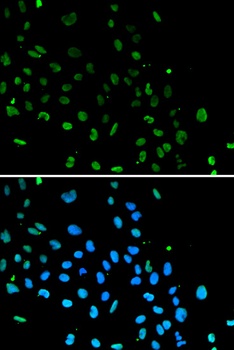 XRCC5 Antibody抗体，orb1257285，bi