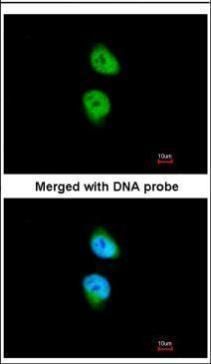 CaMKI delta antibody抗体，orb5562