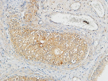 Plasminogen rabbit pAb抗体，orb76