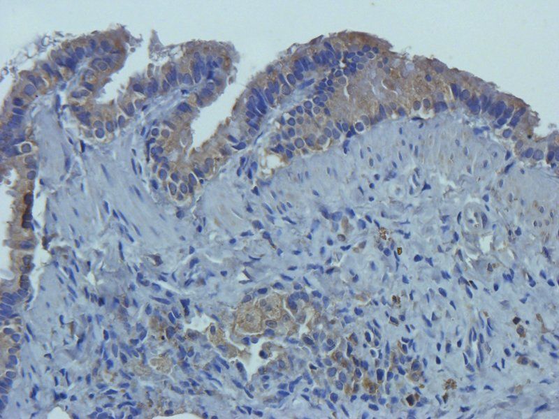 CD14 antibody抗体，orb10294，biorb