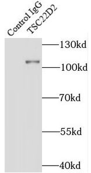 TSC22D2 Antibody抗体，orb632197，b