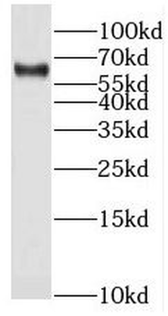 STS Antibody抗体，orb631615，biorb