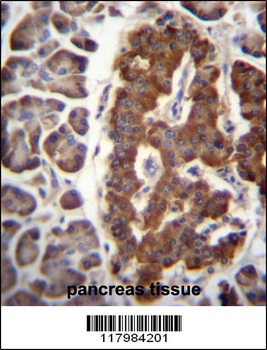 DPT Antibody抗体，orb1269468，bior