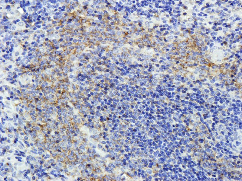 CD20 antibody抗体，orb10307，biorb