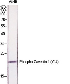 Caveolin-1 (phospho Tyr14) rab