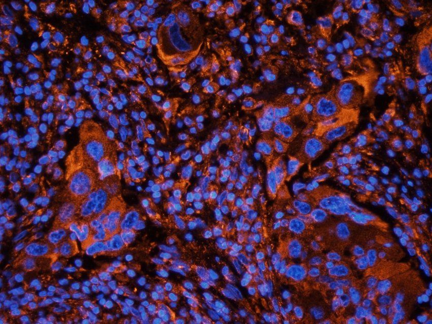 MOGAT1 antibody抗体，orb385431，bi