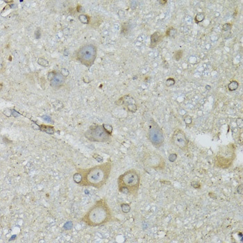 CRYM Antibody抗体,orb1257820,bio