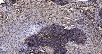 MLK3 (phospho Ser674) rabbit p