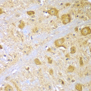 SPAG16 Antibody抗体，orb1256360，b