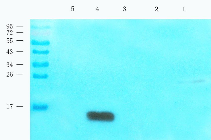 Cystatin C antibody抗体,orb38214