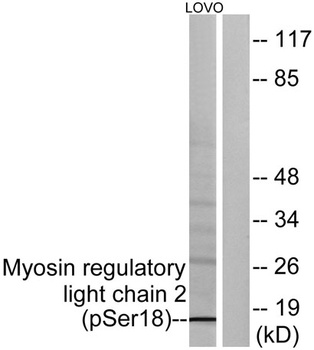 MRLC2 (phospho Ser20) rabbit p