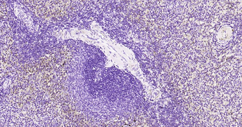 Tau-4 Mouse Monoclonal Antibod