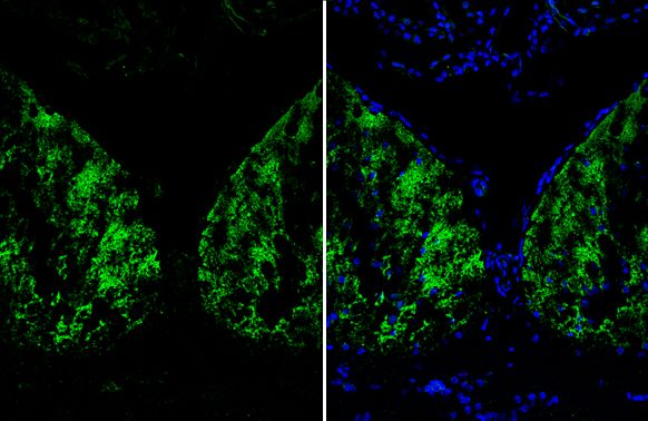 Arginase 1 antibody抗体，orb55659