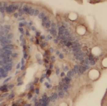 VDAC1 Antibody抗体，orb632900，bio