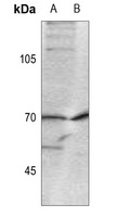 CDC25A (Phospho-S124) Antibody