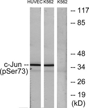 AP-1/Jun D (phospho Ser73/100)