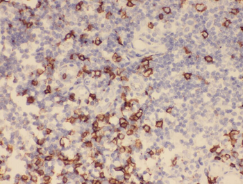 ZAP70 Antibody抗体，orb632676，bio