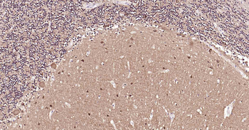 Tau-4 Mouse Monoclonal Antibod