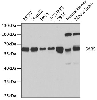 SARS Antibody抗体，orb1260461，bio