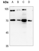 Cathepsin C LC Antibody抗体，orb2