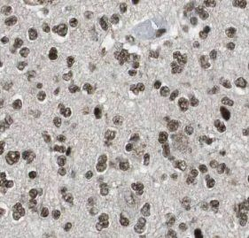 TLE1 Antibody抗体，orb631921，bior