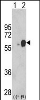 ARSB Antibody (Center)抗体，orb37