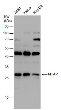 MTAP antibody [N1C3]抗体，orb5565